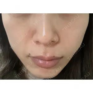 Belle Via Skin Clinic口コミ