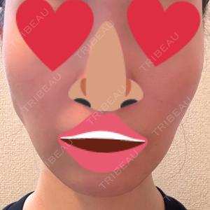 LOUIS CLINIC 二子玉川院【ルイクリニック】口コミ