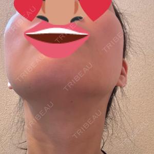 LOUIS CLINIC 二子玉川院【ルイクリニック】口コミ