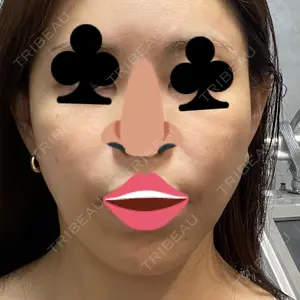 HINATA クリニック口コミ