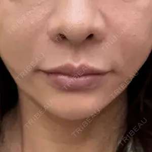 APスキンクリニック銀座口コミ