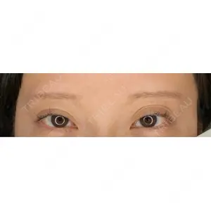 design beauty clinic 梅田本院口コミ