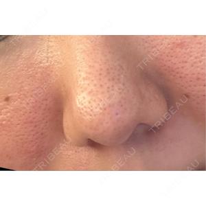 NARU Beauty Clinic NARU Beauty Clinic 【ナルクリ】口コミ