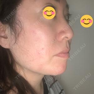 TCB東京中央美容外科 TCB東京中央美容外科 銀座有楽町院口コミ