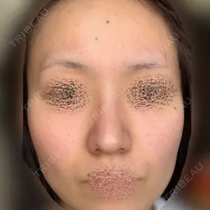 ゆきスキンクリニック 東池袋口コミ