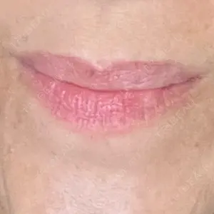 TCB東京中央美容外科 TCB東京中央美容外科 自由が丘院口コミ