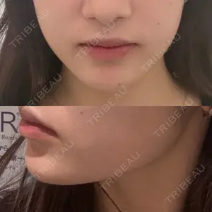 DMTC CLINIC DMTC美容皮膚科 大宮院口コミ