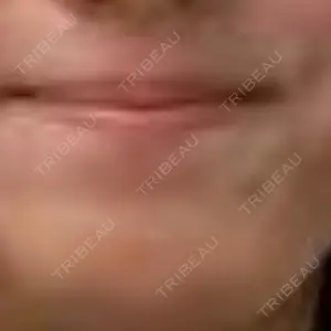 アリエル美容クリニック アリエル美容クリニック 横浜院口コミ