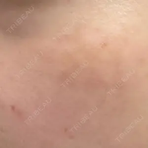 BISIN GINZA CLINIC口コミ