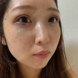 APスキンクリニック銀座口コミ