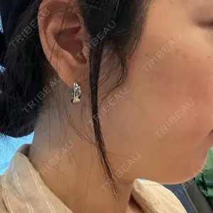 ゆきスキンクリニック 東池袋口コミ