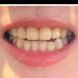 麻布十番クレールデンタルクリニック口コミ