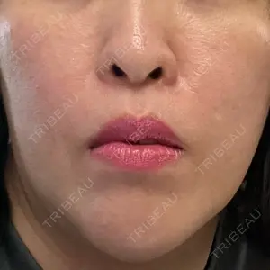 PureMe Skin Clinic（ピュアミースキンクリニック麻布）口コミ
