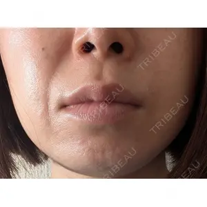 ゆきスキンクリニック 東池袋口コミ