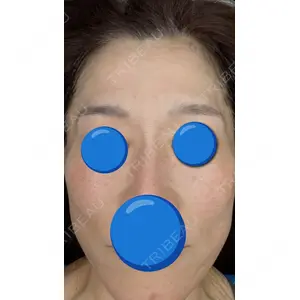 BISIN GINZA CLINIC口コミ