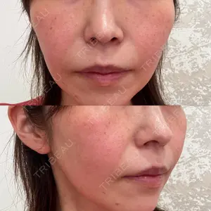 おおかみ美容のクリニック おおかみ美容のクリニック 新宿院口コミ