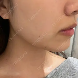 クレオビューティークリニック口コミ