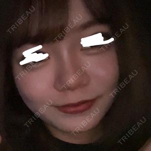 TCB東京中央美容外科 TCB東京中央美容外科 福岡博多院口コミ