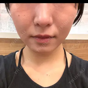 A CLINIC（エークリニック） A CLINIC（エークリニック） 大阪院口コミ