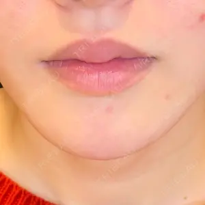 LOUIS CLINIC 二子玉川院【ルイクリニック】口コミ