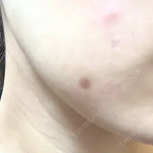 Fellez Clinic【フェルズクリニック】口コミ