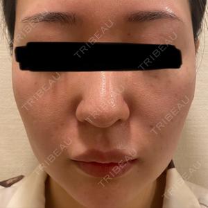 BITO BEAUTY CLINIC BITO BEAUTY CLINIC口コミ