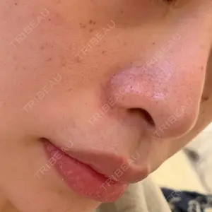 銀座TMクリニック口コミ