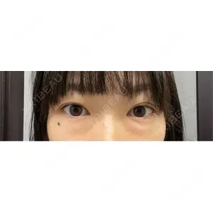 東京BELLEZZAクリニック口コミ