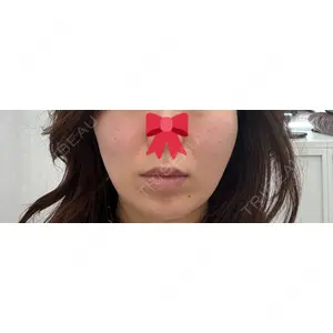 APスキンクリニック銀座の