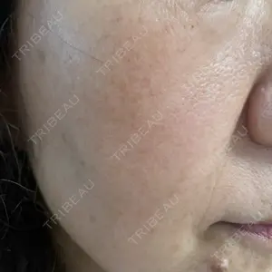 おおかみ美容のクリニック おおかみ美容のクリニック 新宿院口コミ