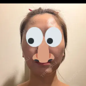 東京シルククリニック 東京シルククリニック 新宿院口コミ