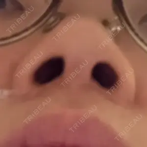 吉祥寺アイビークリニック口コミ