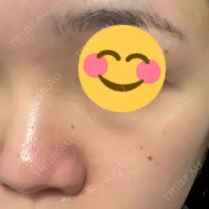 HAAB×DREAM BEAUTY CLINIC HAAB BEAUTY CLINIC 名古屋院口コミ