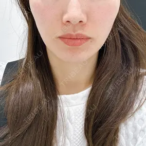 TCB東京中央美容外科 TCB東京中央美容外科 越谷院口コミ