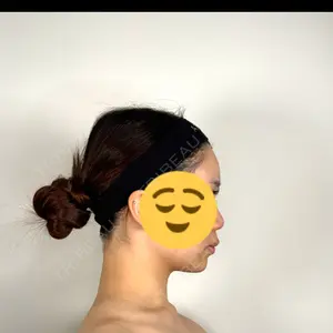 アリエル美容クリニック アリエル美容クリニック 水戸院口コミ