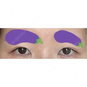 AI Beauty Clinic （エーアイ美容クリニック）口コミ