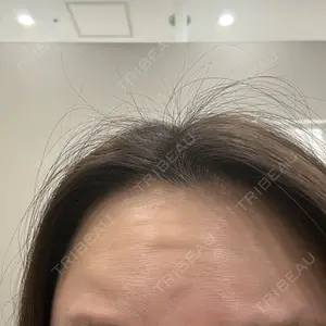 TCB東京中央美容外科 TCB東京中央美容外科 千葉駅前院口コミ