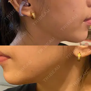 東京シルククリニック 東京シルククリニック 新宿院口コミ