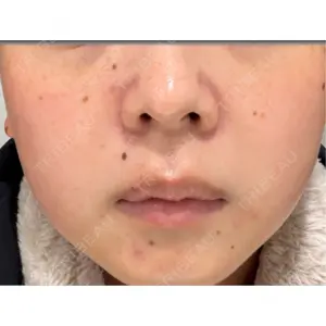 ルラ美容クリニック ルラ美容クリニック 仙台院 / ルラスキンクリニック 仙台院口コミ