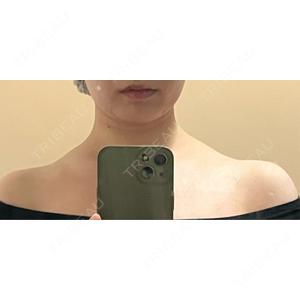 BITO BEAUTY CLINIC BITO BEAUTY CLINIC口コミ