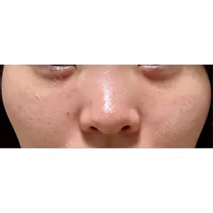 BISIN GINZA CLINIC口コミ