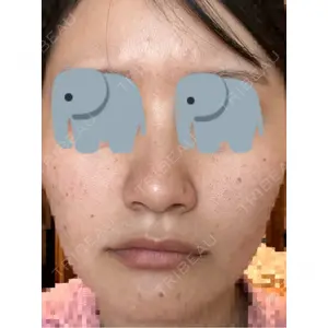 BISIN GINZA CLINIC口コミ