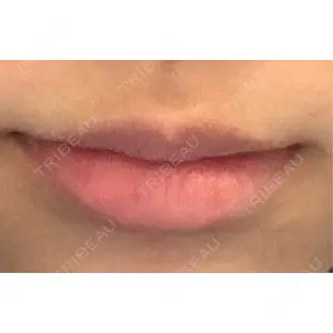フィラークリニック フィラークリニック 新宿院口コミ