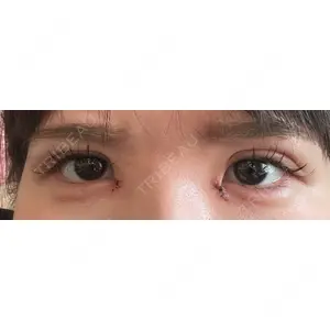 アイビークリニック 吉祥寺アイビークリニック口コミ