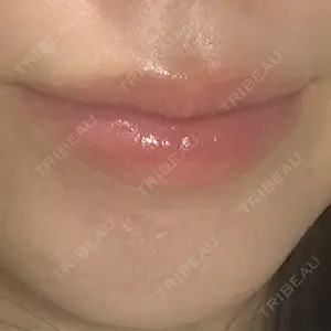 HAAB BEAUTY CLINIC 南青山本院（新院）口コミ