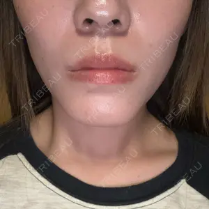 TCB東京中央美容外科 TCB東京中央美容外科 名古屋栄院口コミ