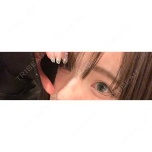 TCB東京中央美容外科 TCB東京中央美容外科 渋谷西口院口コミ