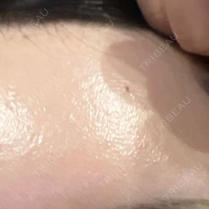 ルラ美容クリニック ルラ美容クリニック 静岡院口コミ