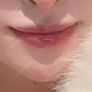 HAAB BEAUTY CLINIC 南青山本院（新院）口コミ