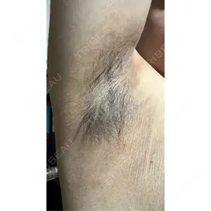 DMTC CLINIC DMTC美容皮膚科 大宮院口コミ